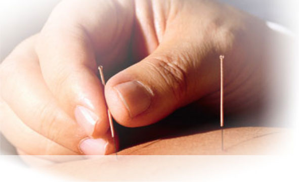 acupuntura_agujas